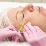 Cosmetologist makes prp therapy against wrinkles around the eyes