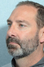 Rhinoplasty
