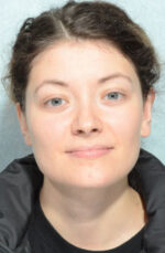 Otoplasty