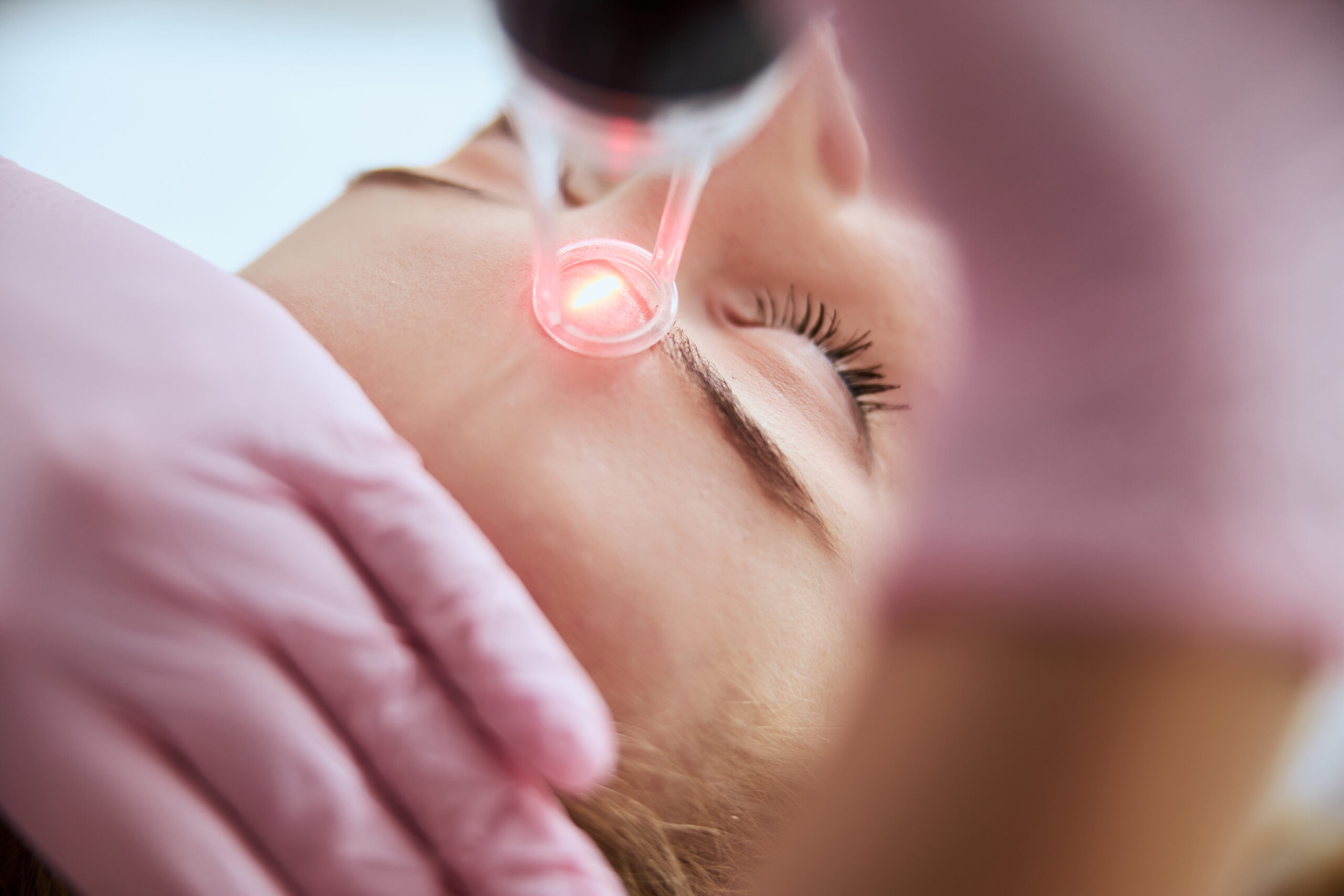 Erbium Laser Skin Resurfacing Recovery 1 erbium laser skin resurfacing recovery scaled