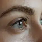 Will I Have Scars After Lower Blepharoplasty (Eyelid Surgery)? 1 Will I Have Scars After Lower Blepharoplasty (Eyelid Surgery)?