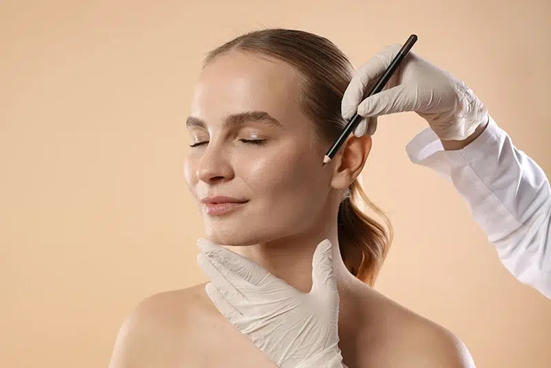 Deep Plane Facelift 1 Doctor in surgical gloves marking a woman's face with a cosmetic pencil before a facial procedure.